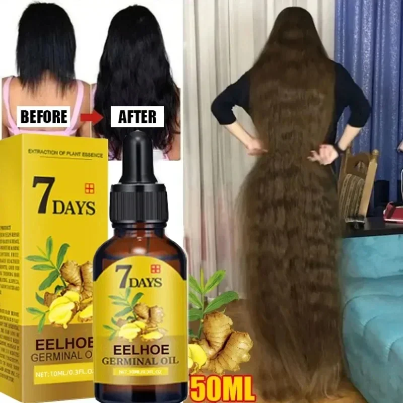 kf-S680fa60333e04d14b1573257ecf8dcefb-7-Day-Fast-Hair-Growth-Oil-Ginger-Growth-Hair-Treatment-Anti-Hair-Loss-Men-Women-Scalp