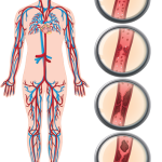 Ai lin ene XHY 888 Bioresonace Therapy device stimulation body